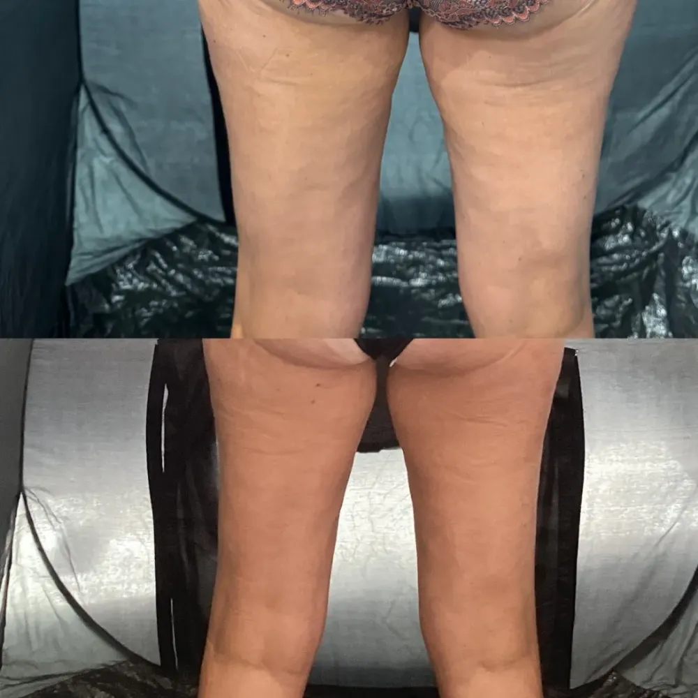 jambes