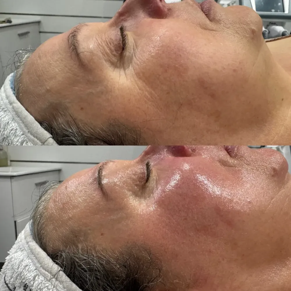 visage soins