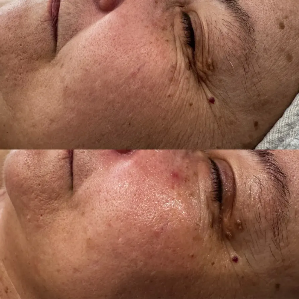Soins visage anti âge à Maintenon