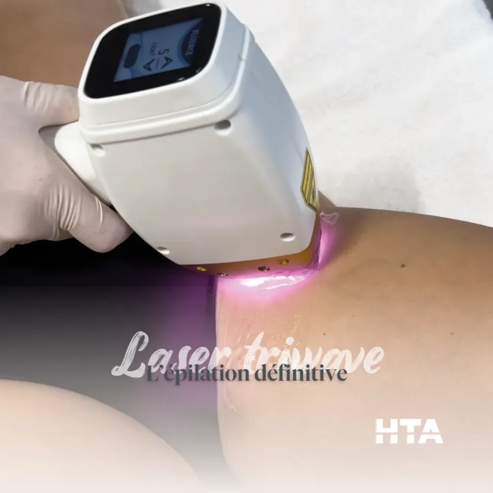 photo onglet epilation dfinitive